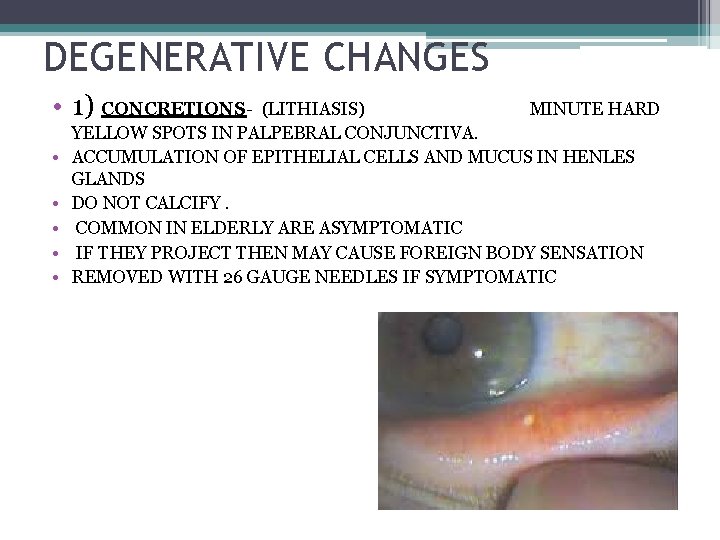 DEGENERATIVE CHANGES • 1) CONCRETIONS • • • (LITHIASIS) MINUTE HARD YELLOW SPOTS IN