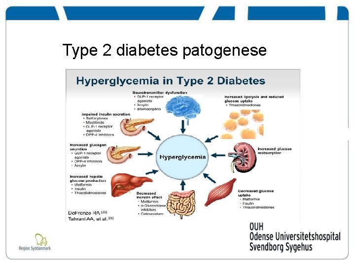 Type 2 diabetes patogenese 