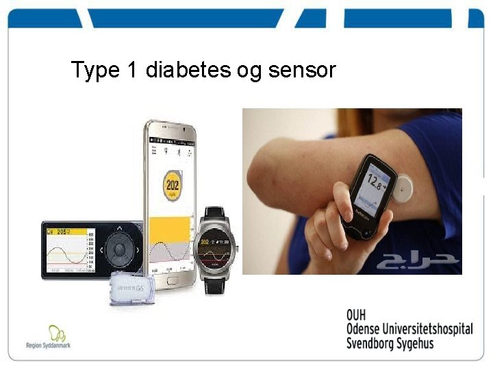  Type 1 diabetes og sensor 