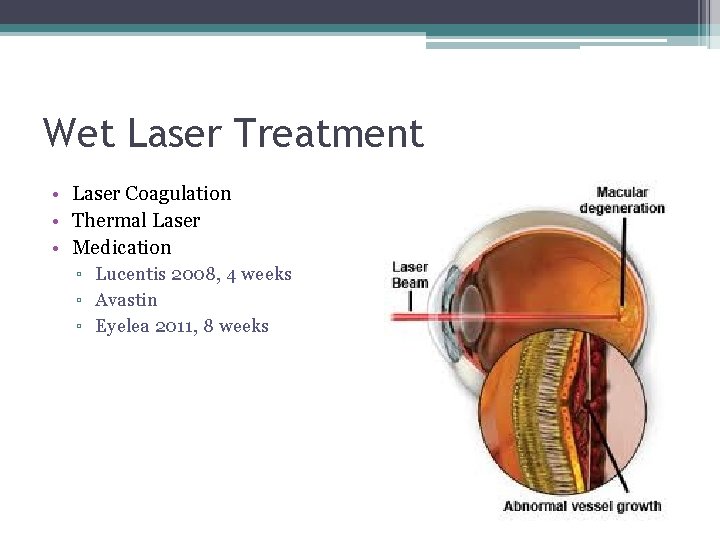 Wet Laser Treatment • Laser Coagulation • Thermal Laser • Medication ▫ Lucentis 2008,