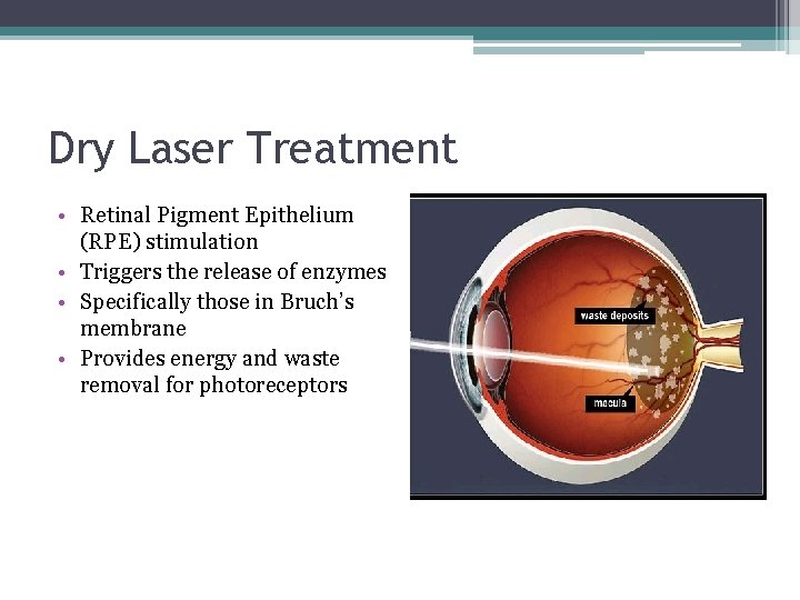 Dry Laser Treatment • Retinal Pigment Epithelium (RPE) stimulation • Triggers the release of