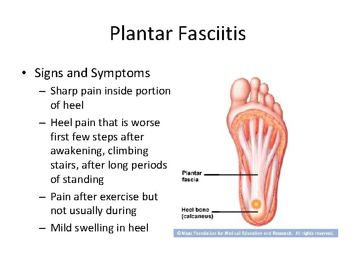 Plantar Fasciitis • Signs and Symptoms – Sharp pain inside portion of heel –
