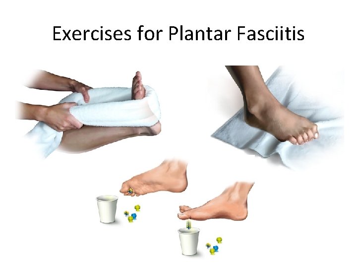 Exercises for Plantar Fasciitis 