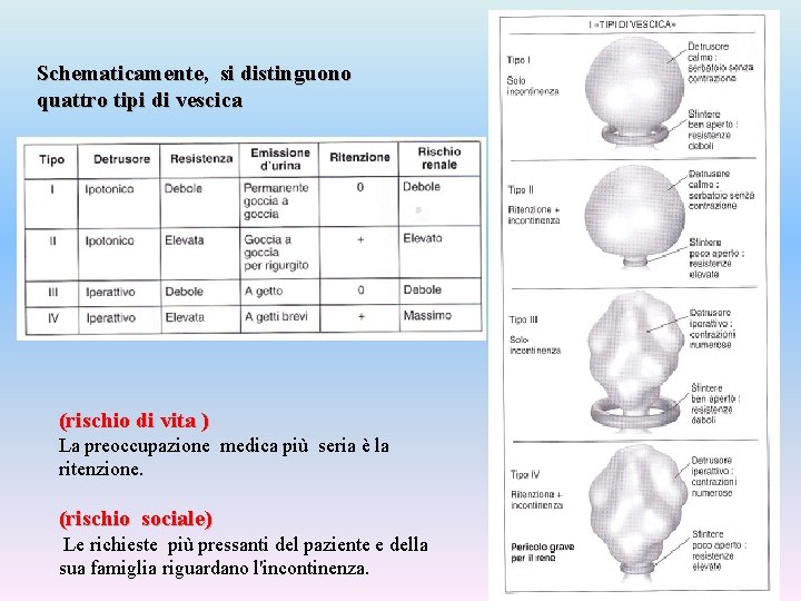 Schematicamente, si distinguono quattro tipi di vescica (rischio di vita ) La preoccupazione medica