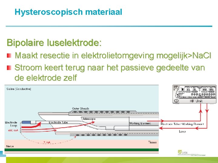 Hysteroscopisch materiaal Bipolaire luselektrode: Maakt resectie in elektrolietomgeving mogelijk>Na. Cl Stroom keert terug naar