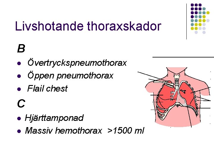 Livshotande thoraxskador B Övertryckspneumothorax Öppen pneumothorax Flail chest l l l C l l