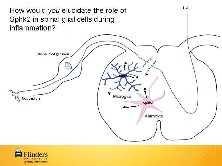 How would you elucidate the role of Sphk 2 in spinal glial cells during