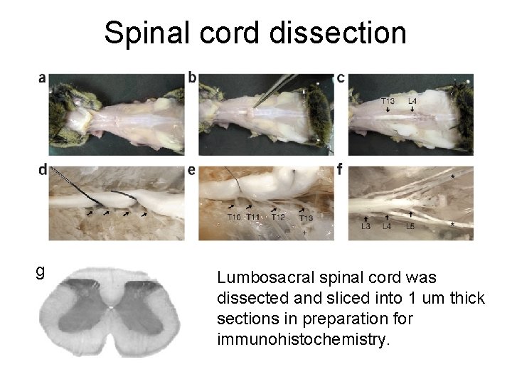 Spinal cord dissection g Lumbosacral spinal cord was dissected and sliced into 1 um