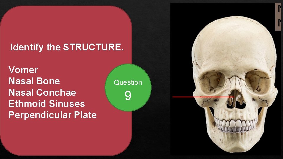 Identify the STRUCTURE. Vomer Nasal Bone Nasal Conchae Ethmoid Sinuses Perpendicular Plate Question 9