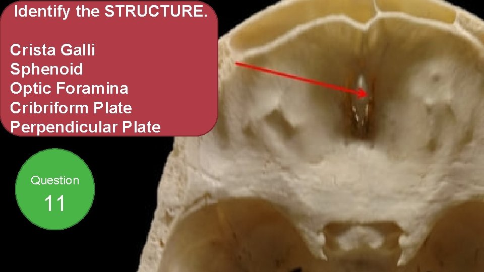 Identify the STRUCTURE. Crista Galli Sphenoid Optic Foramina Cribriform Plate Perpendicular Plate Question 11