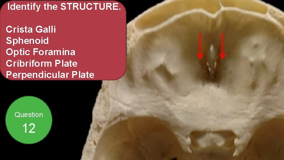 Identify the STRUCTURE. Crista Galli Sphenoid Optic Foramina Cribriform Plate Perpendicular Plate Question 12