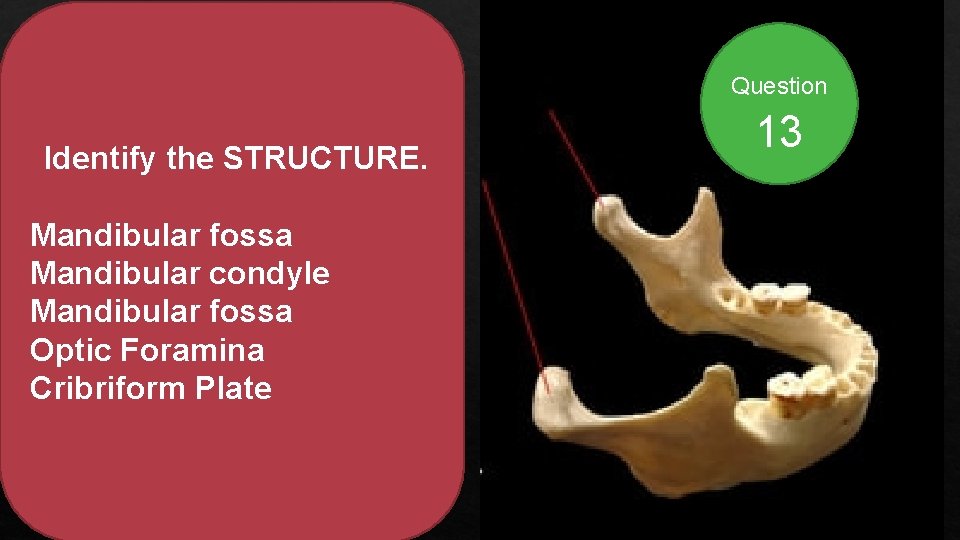 Question Identify the STRUCTURE. Mandibular fossa Mandibular condyle Mandibular fossa Optic Foramina Cribriform Plate
