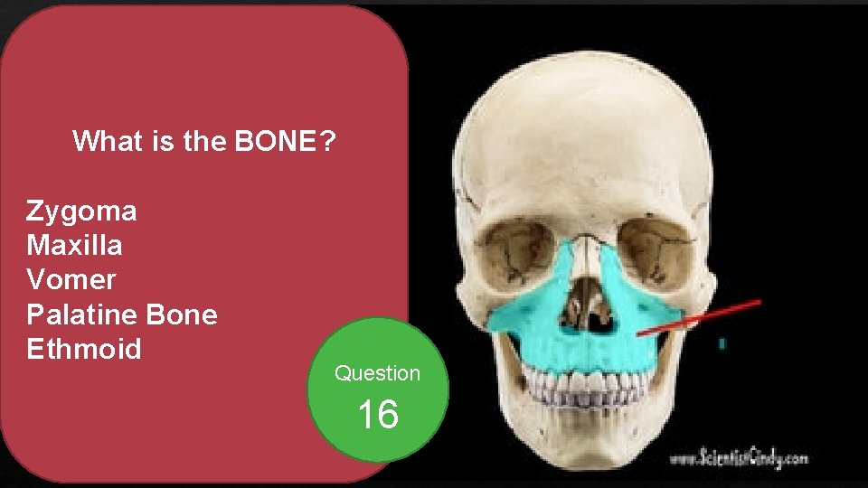 What is the BONE? Zygoma Maxilla Vomer Palatine Bone Ethmoid Question 16 