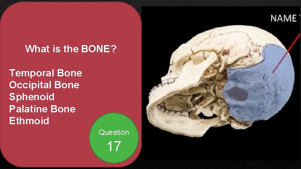 What is the BONE? Temporal Bone Occipital Bone Sphenoid Palatine Bone Ethmoid Question 17