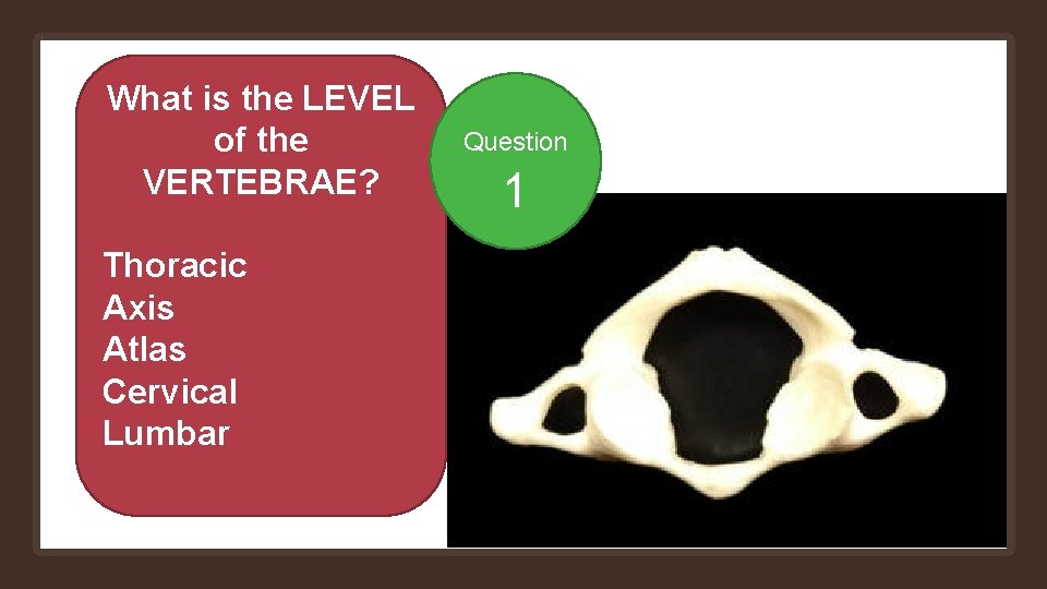 What is the LEVEL of the VERTEBRAE? Thoracic Axis Atlas Cervical Lumbar Question 1