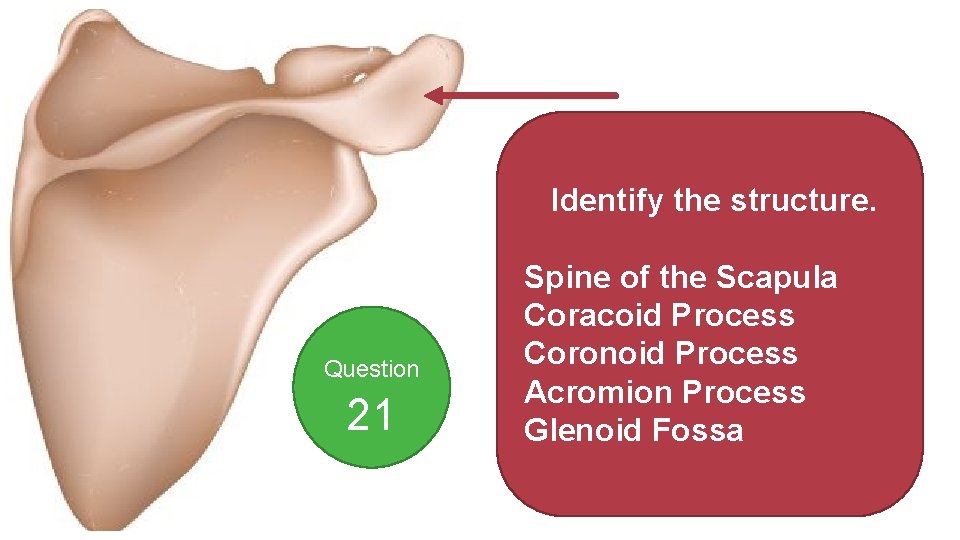 Identify the structure. Question 21 Spine of the Scapula Coracoid Process Coronoid Process Acromion