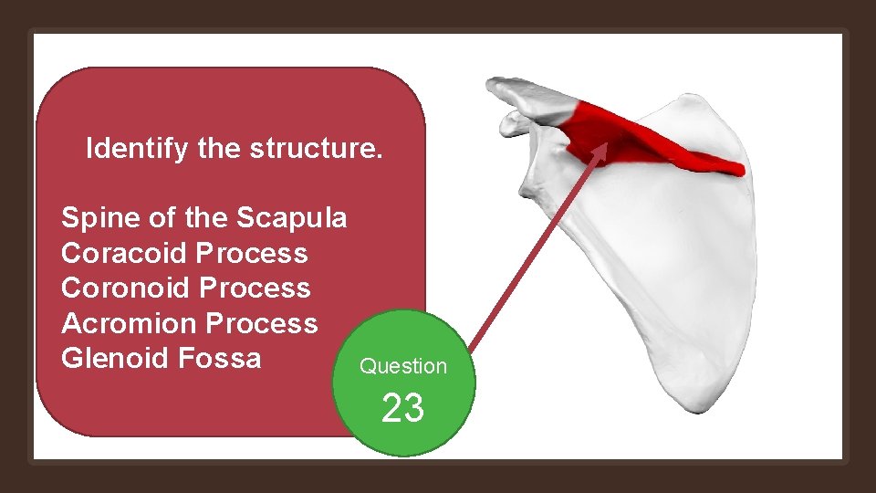Identify the structure. Spine of the Scapula Coracoid Process Coronoid Process Acromion Process Glenoid