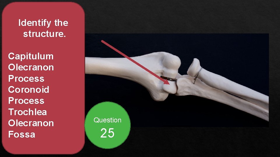 Identify the structure. Capitulum Olecranon Process Coronoid Process Trochlea Olecranon Fossa Question 25 