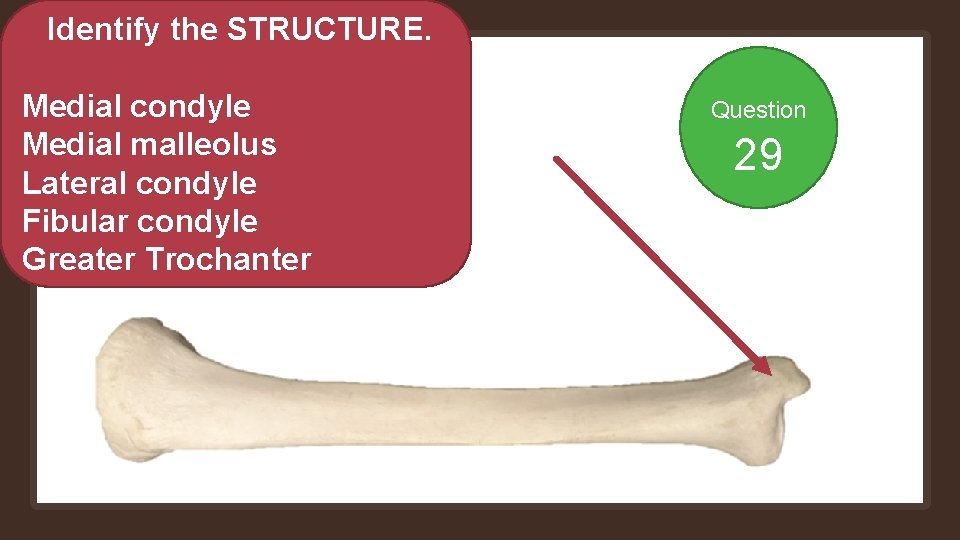 Identify the STRUCTURE. Medial condyle Medial malleolus Lateral condyle Fibular condyle Greater Trochanter Question