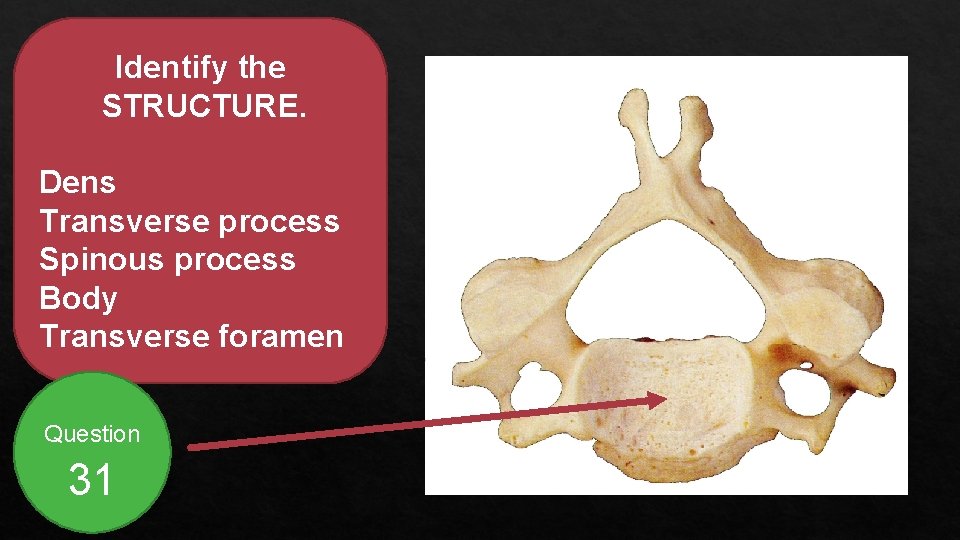 Identify the STRUCTURE. Dens Transverse process Spinous process Body Transverse foramen Question 31 