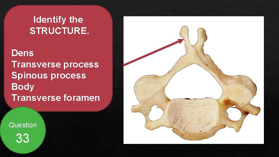 Identify the STRUCTURE. Dens Transverse process Spinous process Body Transverse foramen Question 33 