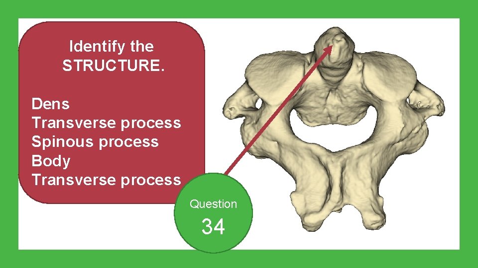 Identify the STRUCTURE. Dens Transverse process Spinous process Body Transverse process Question 34 