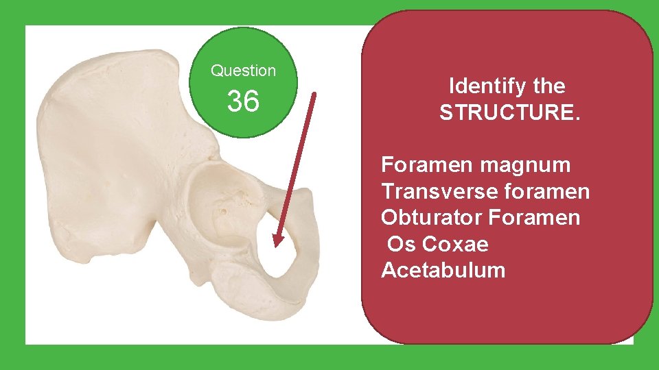 Question 36 Identify the STRUCTURE. Foramen magnum Transverse foramen Obturator Foramen Os Coxae Acetabulum