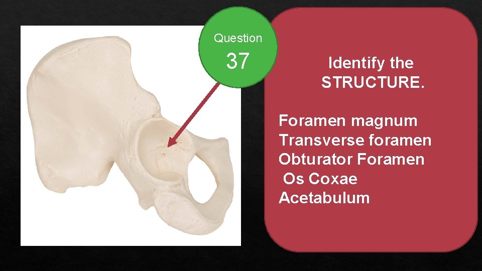 Question 37 Identify the STRUCTURE. Foramen magnum Transverse foramen Obturator Foramen Os Coxae Acetabulum