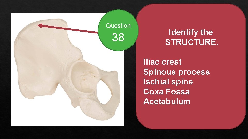 Question 38 Identify the STRUCTURE. Iliac crest Spinous process Ischial spine Coxa Fossa Acetabulum