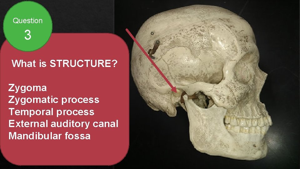 Question 3 What is STRUCTURE? Zygomatic process Temporal process External auditory canal Mandibular fossa