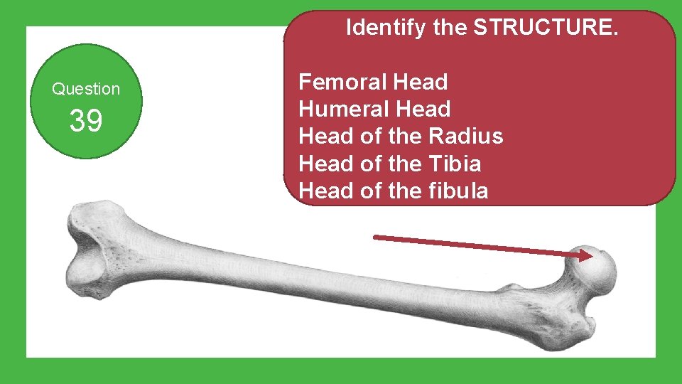 Identify the STRUCTURE. Question 39 Femoral Head Humeral Head of the Radius Head of