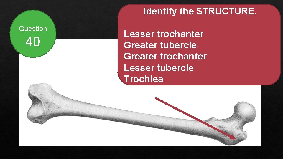 Identify the STRUCTURE. Question 40 Lesser trochanter Greater tubercle Greater trochanter Lesser tubercle Trochlea