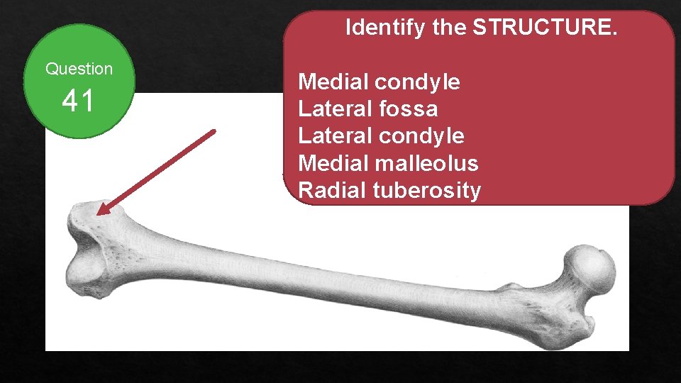 Identify the STRUCTURE. Question 41 Medial condyle Lateral fossa Lateral condyle Medial malleolus Radial