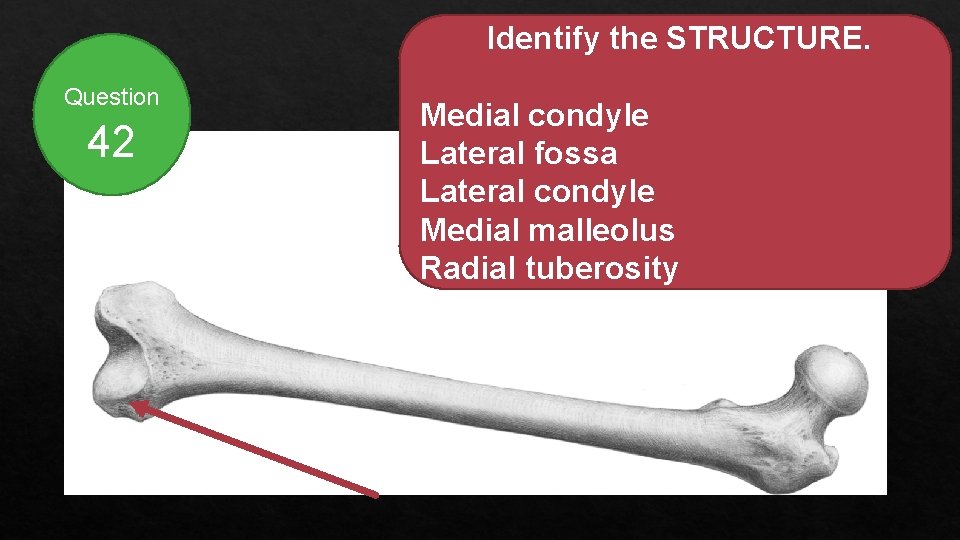 Identify the STRUCTURE. Question 42 Medial condyle Lateral fossa Lateral condyle Medial malleolus Radial