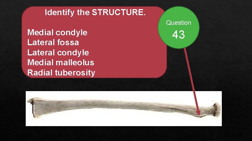 Identify the STRUCTURE. Question Medial condyle Lateral fossa Lateral condyle Medial malleolus Radial tuberosity