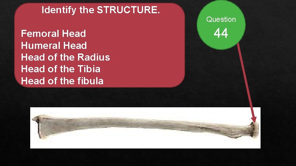 Identify the STRUCTURE. Femoral Head Humeral Head of the Radius Head of the Tibia