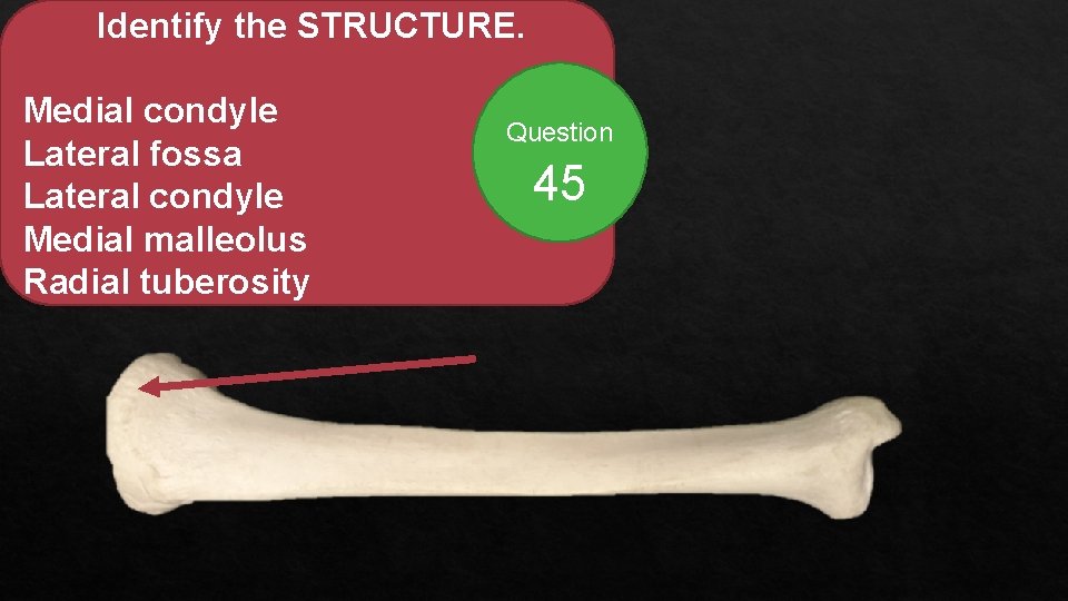 Identify the STRUCTURE. Medial condyle Lateral fossa Lateral condyle Medial malleolus Radial tuberosity Question
