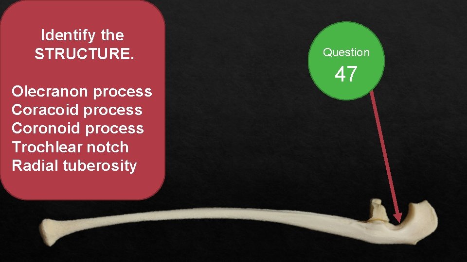 Identify the STRUCTURE. Olecranon process Coracoid process Coronoid process Trochlear notch Radial tuberosity Question
