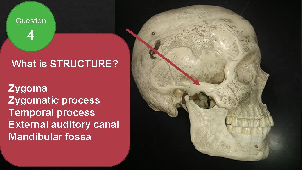 Question 4 What is STRUCTURE? Zygomatic process Temporal process External auditory canal Mandibular fossa