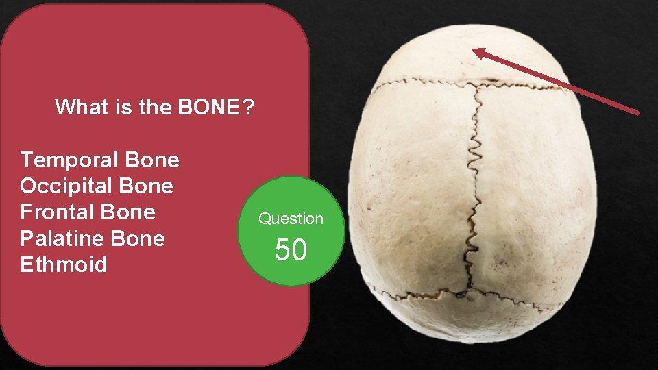 What is the BONE? Temporal Bone Occipital Bone Frontal Bone Palatine Bone Ethmoid Question
