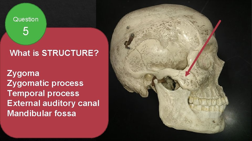 Question 5 What is STRUCTURE? Zygomatic process Temporal process External auditory canal Mandibular fossa