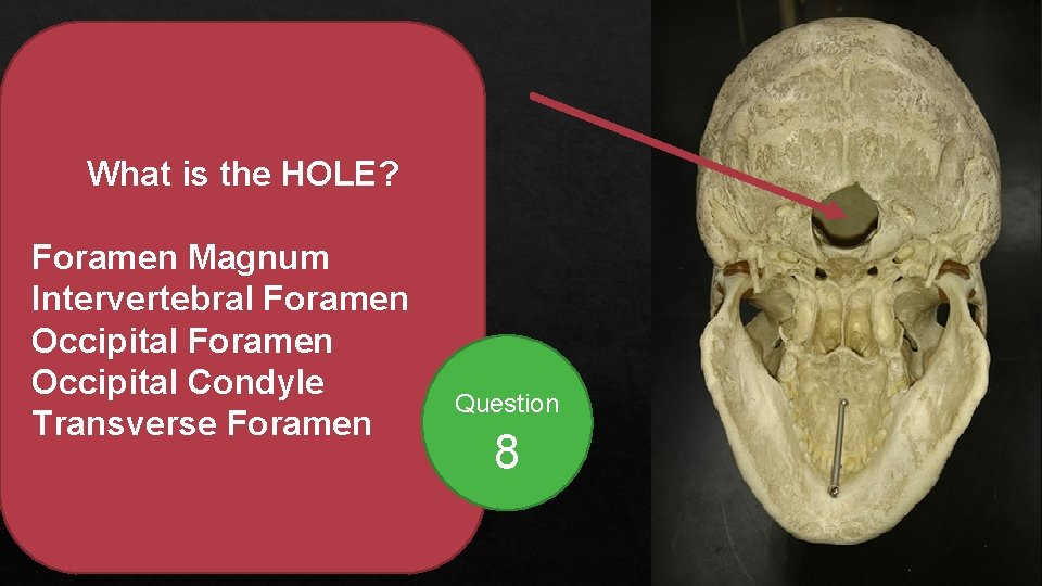 What is the HOLE? Foramen Magnum Intervertebral Foramen Occipital Condyle Transverse Foramen Question 8