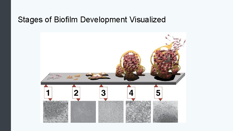 Stages of Biofilm Development Visualized 