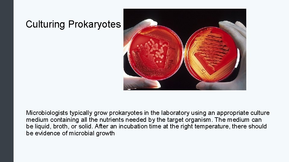 Culturing Prokaryotes Microbiologists typically grow prokaryotes in the laboratory using an appropriate culture medium