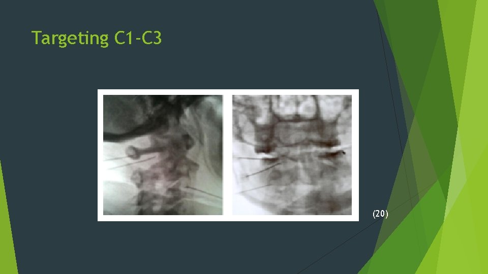 Targeting C 1 -C 3 (20) 