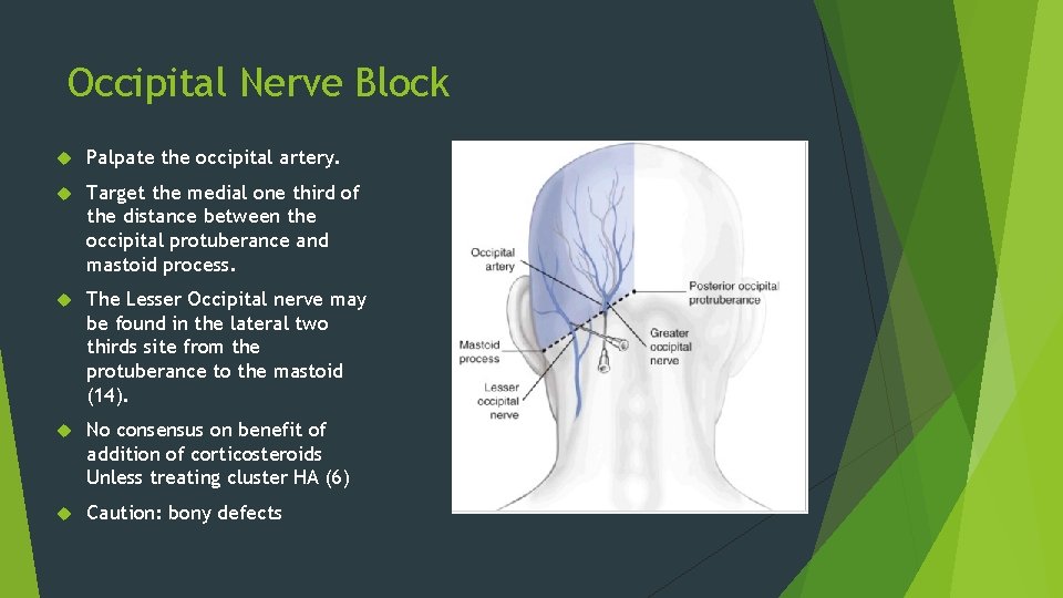 Occipital Nerve Block Palpate the occipital artery. Target the medial one third of the