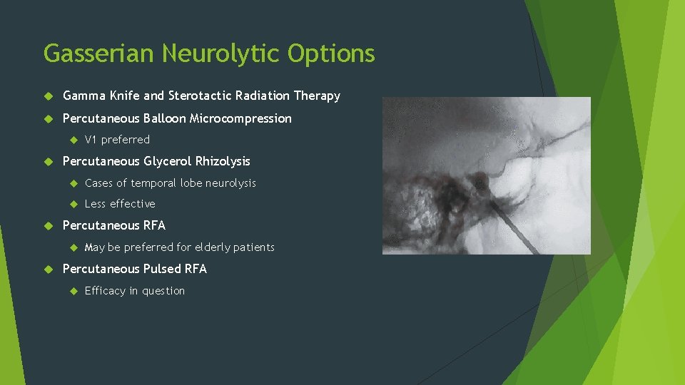Gasserian Neurolytic Options Gamma Knife and Sterotactic Radiation Therapy Percutaneous Balloon Microcompression Percutaneous Glycerol