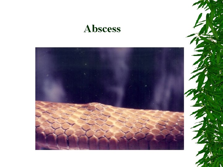 Abscess 