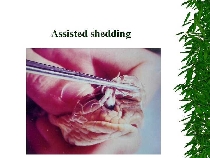 Assisted shedding 