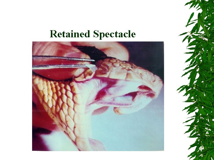 Retained Spectacle 